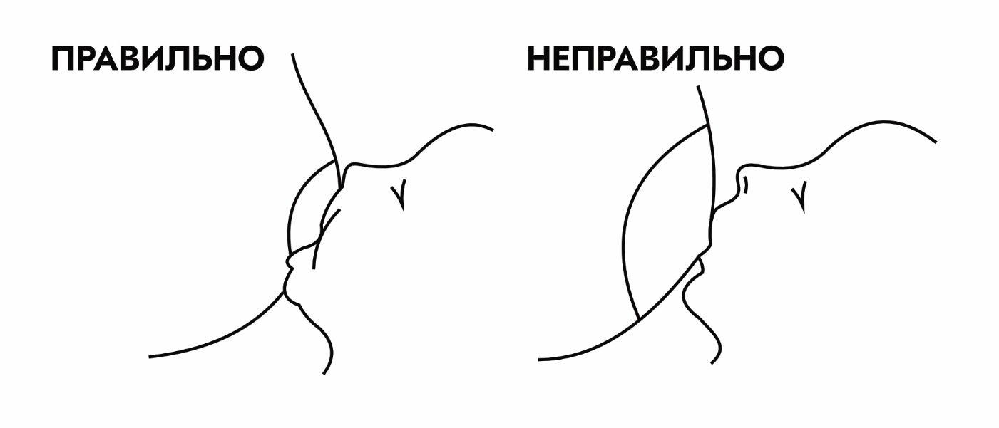 Лечение прочей потливости (промежность, складки под грудью и пр.)